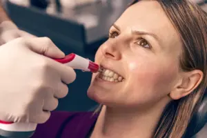 teeth whitening concept 2025 02 22 16 07 24 utc